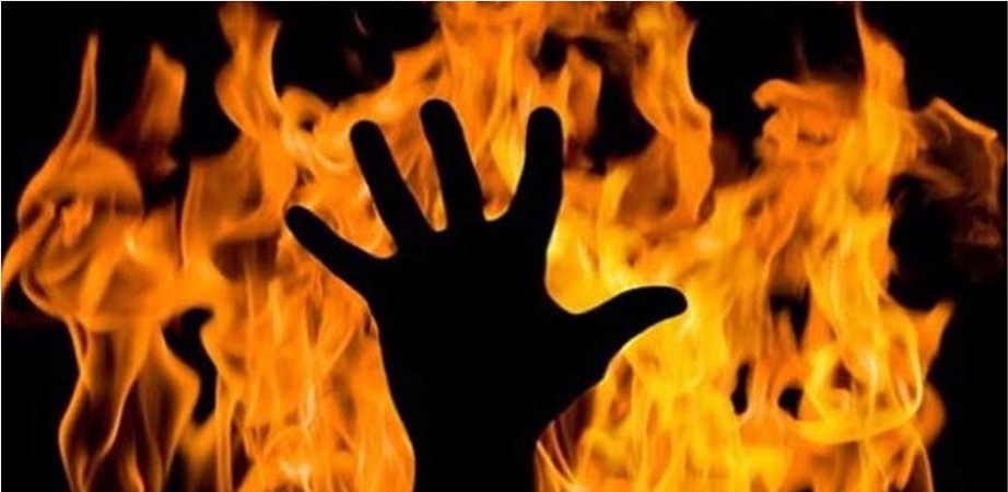 नवलपुर आगो ताप्ने क्रममा जलेर घाइते